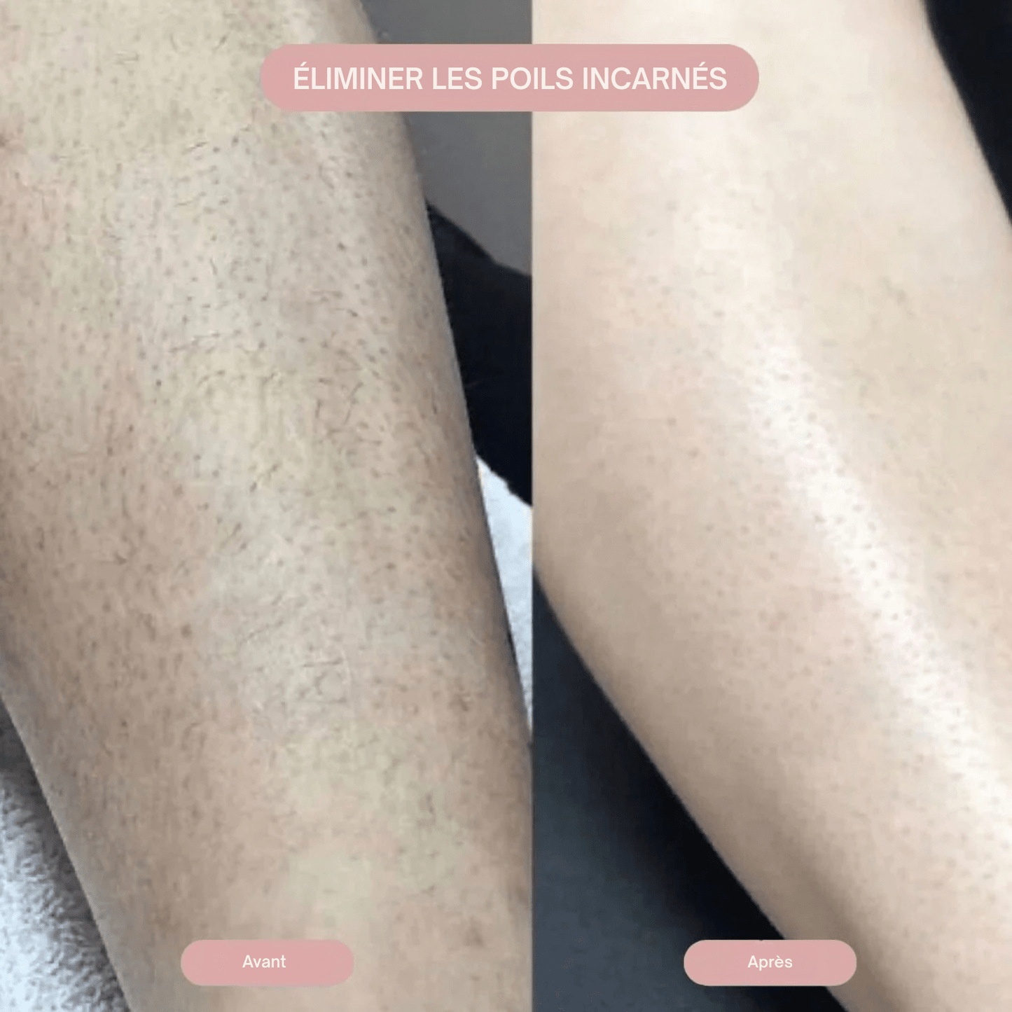 Lumea epi - Rasoio da donna 2 in 1