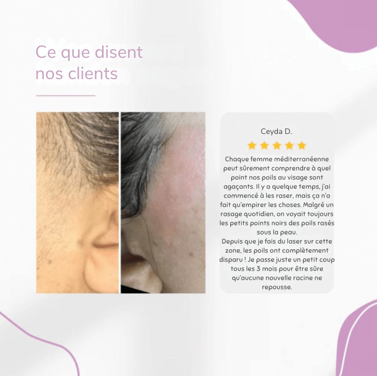 Lumea Epi • Épilateur à Lumière Pulsée •