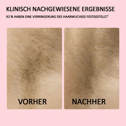 Lumea Epi •IPL-Haarentfernungsgerät