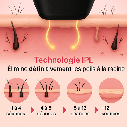 Lumea Epi • Épilateur à Lumière Pulsée  •