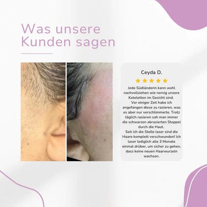 Lumea Epi •IPL-Haarentfernungsgerät