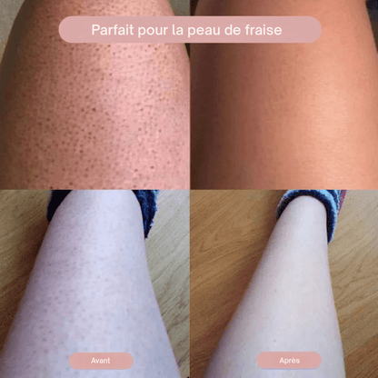 Lumea épi - Rasoir 2-en-1 pour Femmes