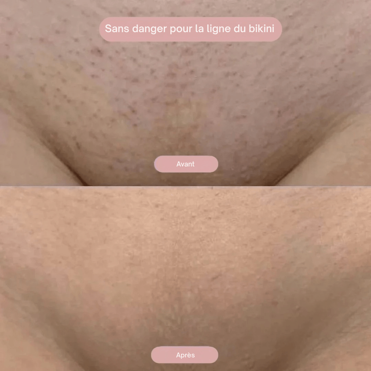 Lumea épi - Rasoir 2-en-1 pour Femmes