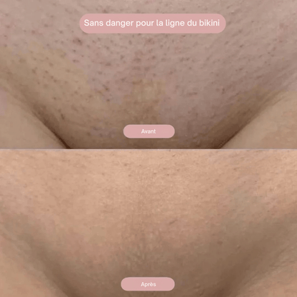 Lumea épi - Rasoir 2-en-1 pour Femmes