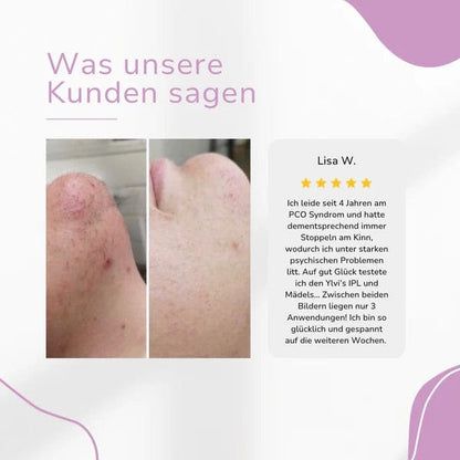Lumea Epi •IPL-Haarentfernungsgerät