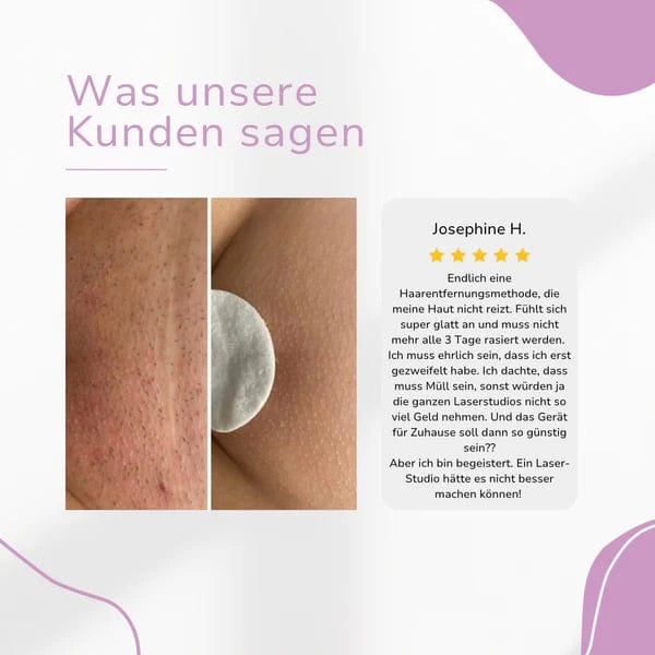 Lumea Epi •IPL-Haarentfernungsgerät