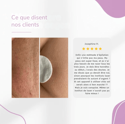 Lumea Epi • Épilateur à Lumière Pulsée  •